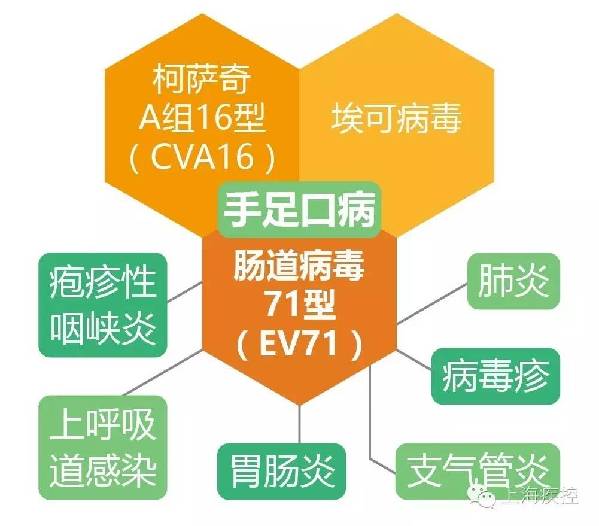 重症手足口病有了"克星" 沪5岁以下小囡可以打ev71疫苗了!