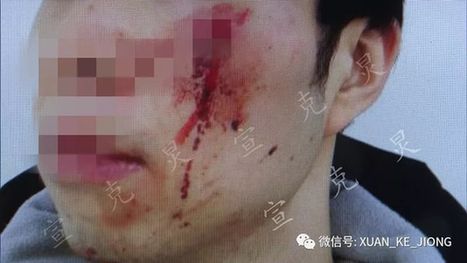 上海热线HOT新闻--地铁13号线因为拥挤引发纠