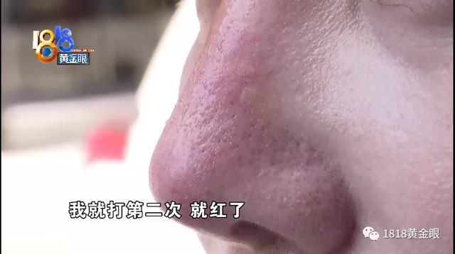 养生馆里隆鼻变红鼻子?找人"背锅"反被录音