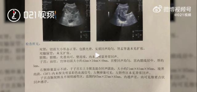 别再憋尿了女生过年喝多了憋尿导致黄体破裂后果很严重