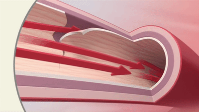 400_226gif 动态图 动图