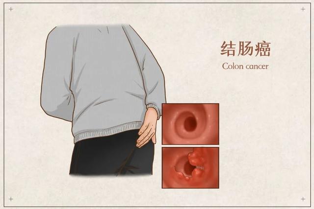 瓜子嗑不对可能致癌!