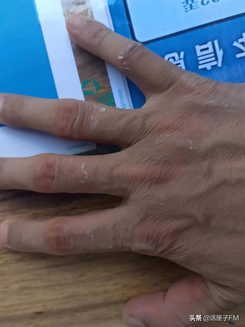 怎么样才能减少手出汗 IMGb8ca3abea89360735232258.jpeg