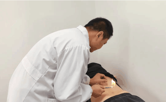 传承“火针疗法”，天山中医医院有一套！——上海热线HOT频道